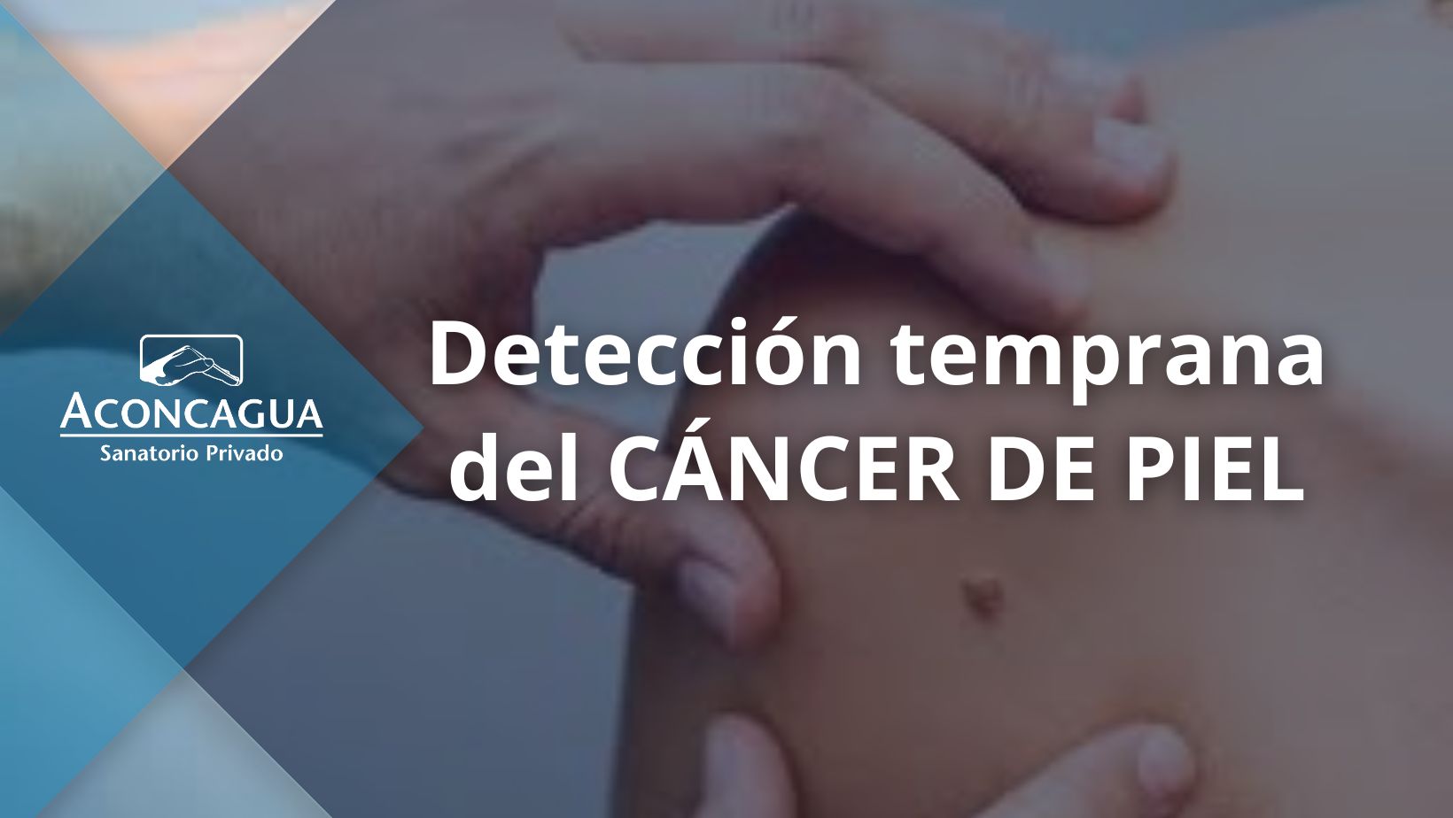 Detectar el cáncer de piel